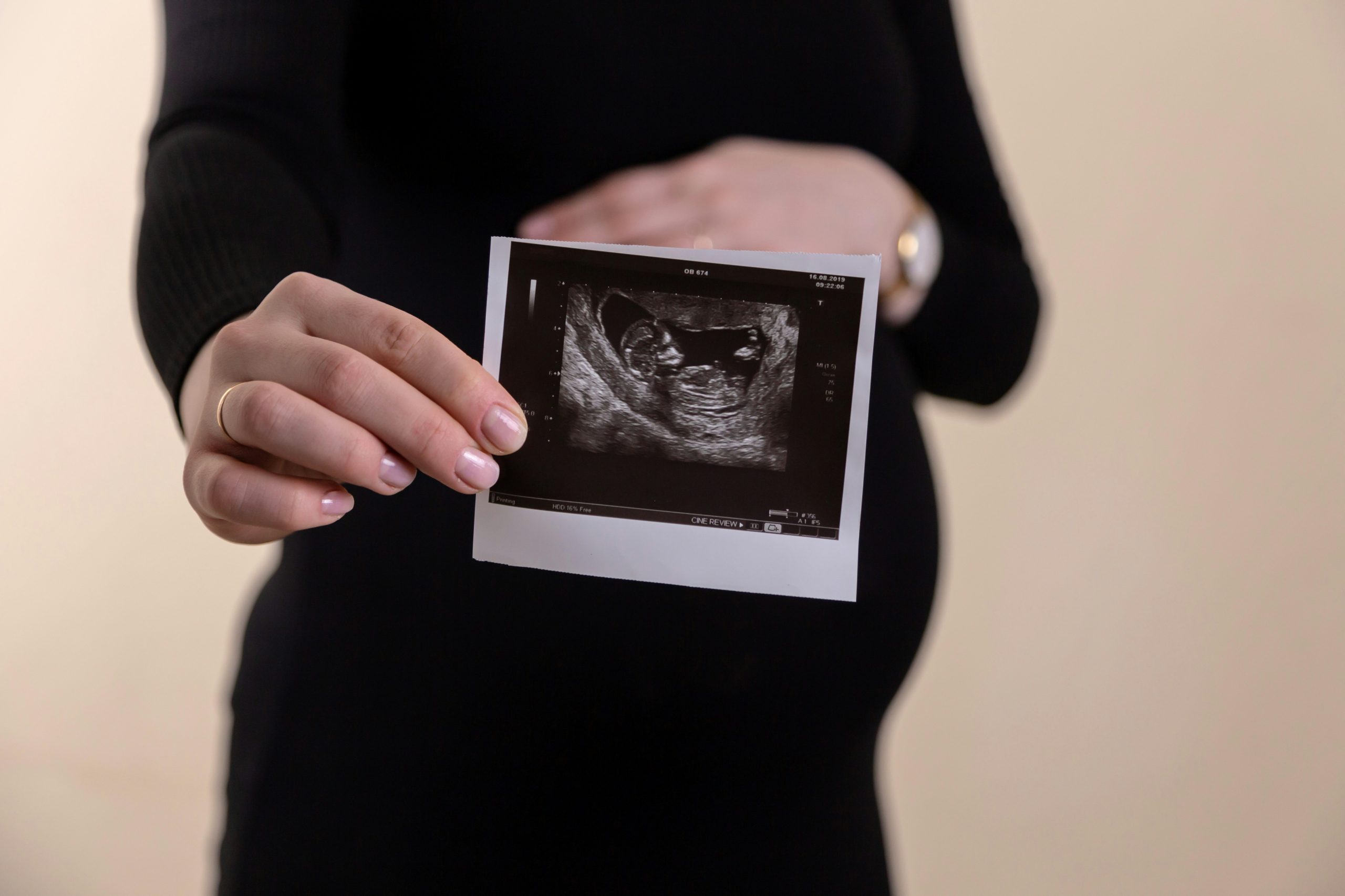 Surrogate holding ultrasound image of pregnancy she is carrying for another person